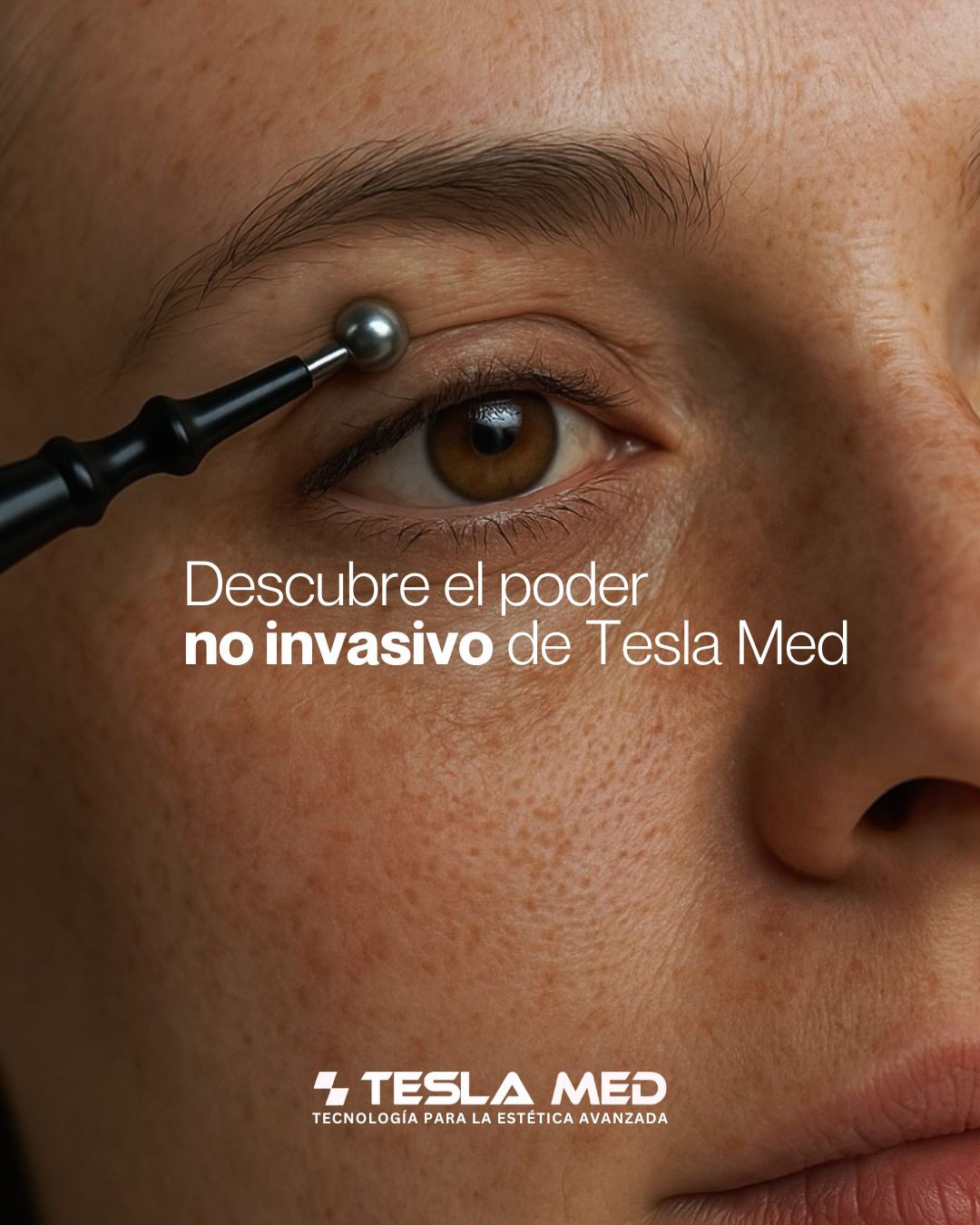 Tratamiento Mirada infinita con Tesla med